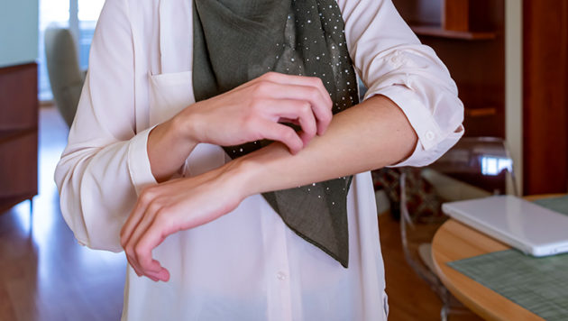 woman scratching her arm